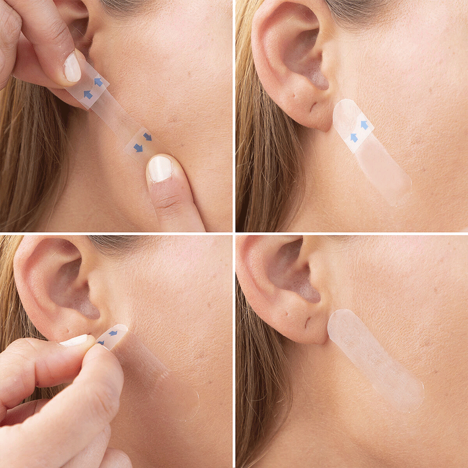 Set de 40 patchs de lifting facial invisibles InnovaGoods – Image 2